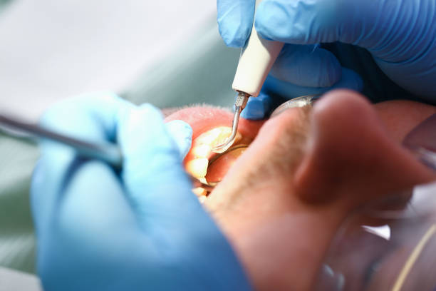 Best Emergency Dental Care for Abscessed Tooth in Whitfield, PA